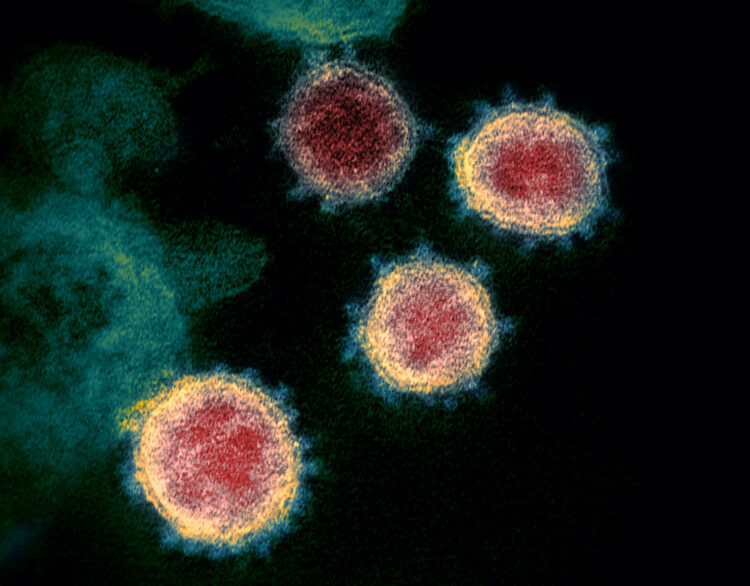 Newswise: LJI scientists identify potential targets for immune responses to novel coronavirus