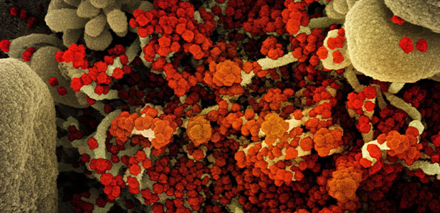 Colorized scanning electron micropgraph of an apoptotic cell heavily infected with SARS-CoV-2. Credit: NIAID.