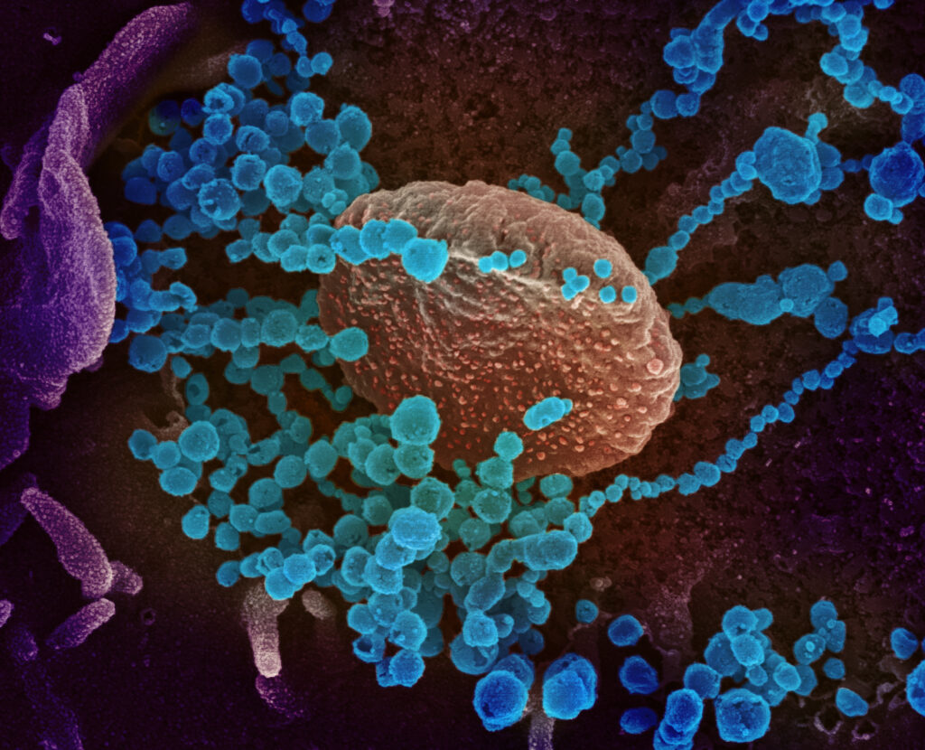 This scanning electron microscope image shows SARS-CoV-2 (round blue objects) emerging from the surface of cells cultured in the lab. Credit: NIAID