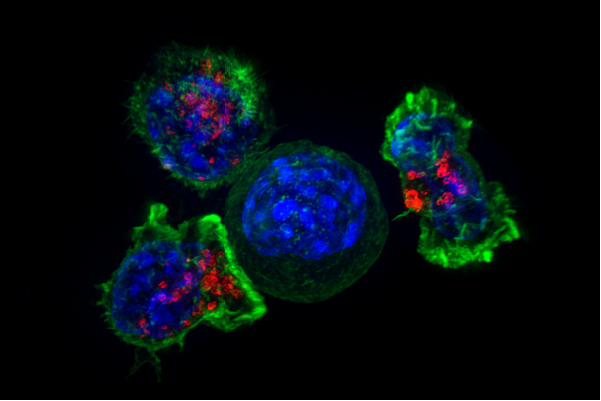 Prolonged overactivity of killer T cells summoned to a tumor site can render them useless, a cellular state immunologists call "exhaustion." Image: Superresolution image of a group of killer T cells (green and red) surrounding a cancer cell (blue). Courtesy of National Institutes of Health. 