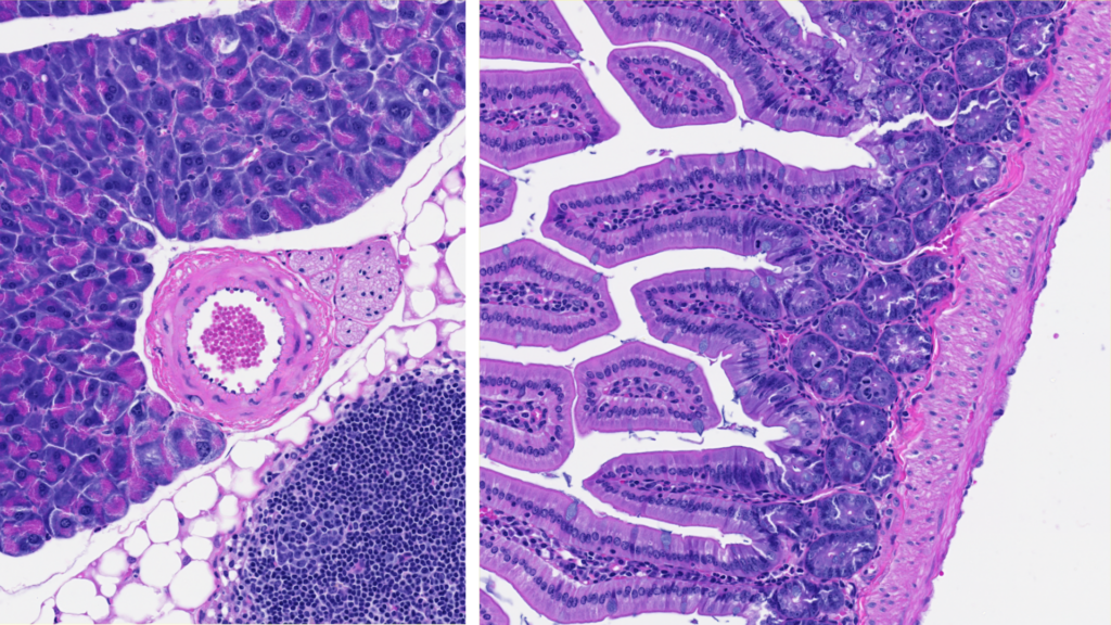 Two histology images of mouse lung tissues. Shows barrier cells a cell and potential cell nucleus
