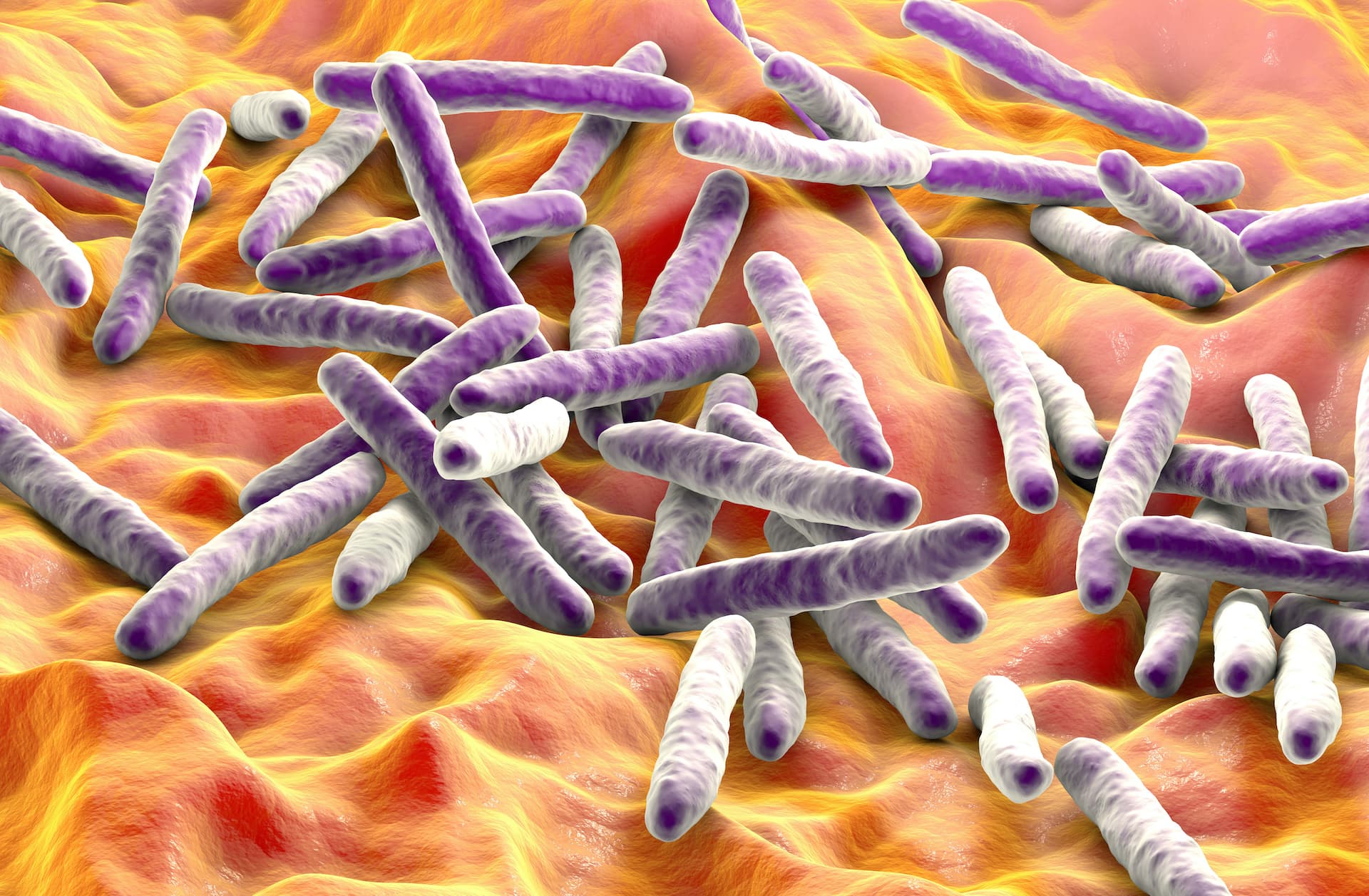  A digital rendering of rod-shaped mycobacteria. Bacteria are shown in 3D. Purple bacteria on an orange background. Licensed for use from Shutterstock.