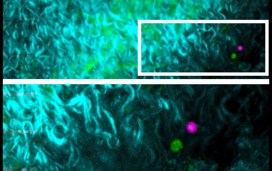 The researchers used fluorescent tags to capture this image of a Treg (green) and an exTregs (pink) in a mouse artery wall. (Image from Nature Immunology, Aug. 2023)

