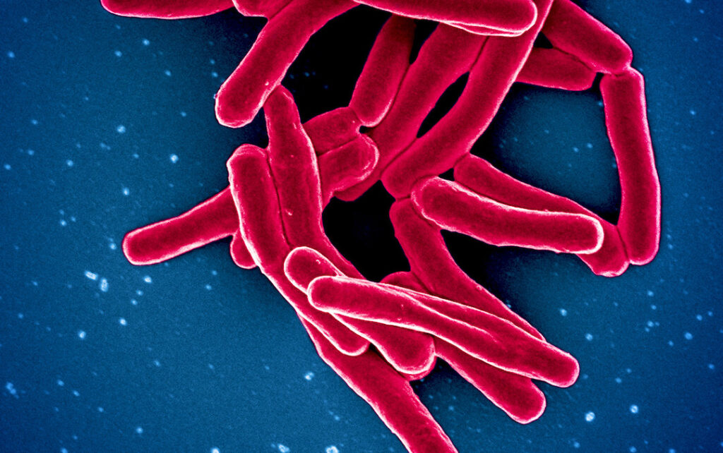 Scanning electron micrograph of Mycobacterium tuberculosis particles (colorized red), the bacterium which causes TB. Credit: NIAID