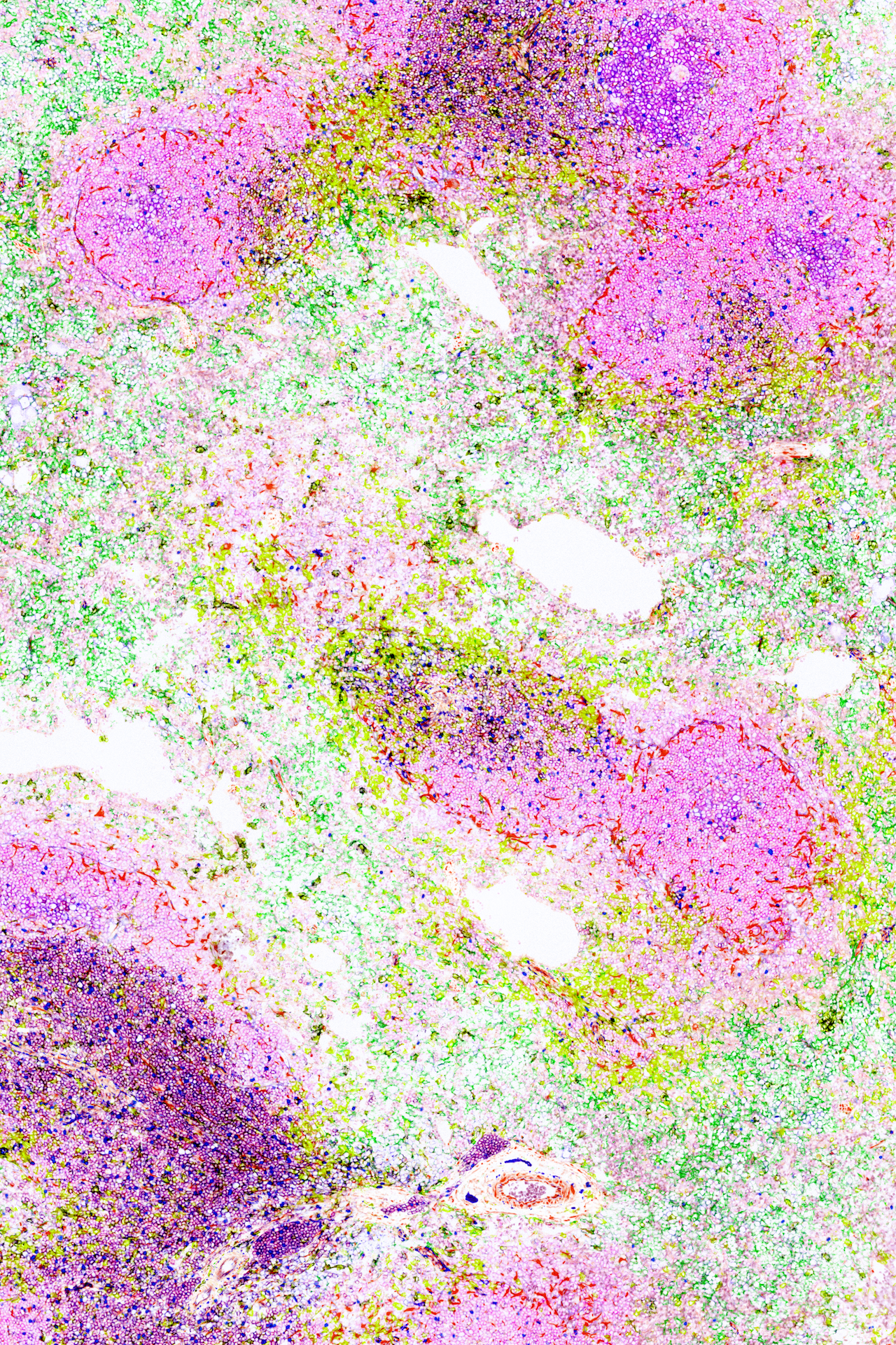 We are looking at a mouse spleen with lymphoid follicles (pink) hugged by the layer of supporting cells (red). Germinal centers (purple) on the top of the image are lled with large, multiplying B cells. T cells are located close to B cells while macrophages (green and yellow) keep a larger distance. Images like these help us to better understand how to make more eective vaccines.