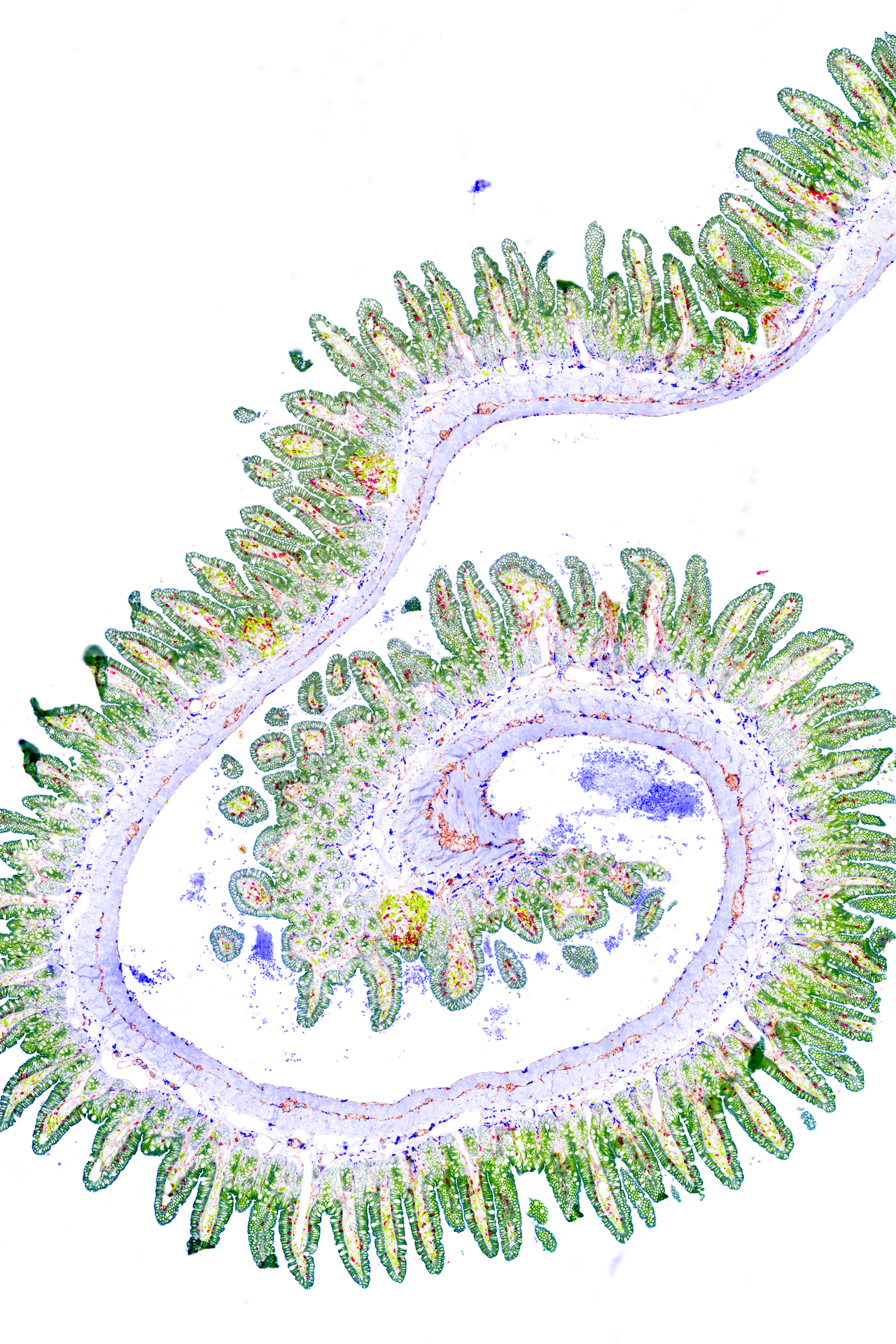 A mouse small intestine sample shows nger-like projections lined with epithelial cells (green), guarded by T cells (red). Inammatory bowel diseases and celiac disease often start at this interface. Take a look at the orange layer of neurons sandwiched between the muscle cells (fuchsia). On closer inspection, you can nd immune cells called macrophages (deep blue) that are in direct contact with the orange neurons.