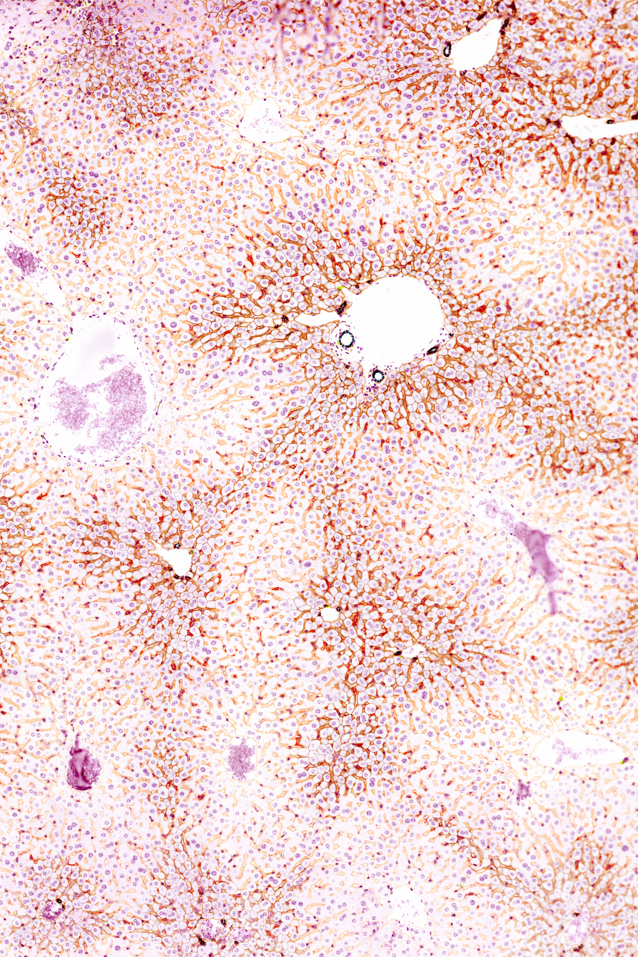 This piece of mouse liver illustrates the incredible architecture of our bodies. Cells are precisely arranged to form a network of channels (light orange) that are lined by macrophage cells (red). Some cells in the liver have multiple nuclei (purple), which help them optimize their metabolism. Viral infections, diabetes, and other metabolic diseases that disturb this structure can lead to the formation of liver tumors.