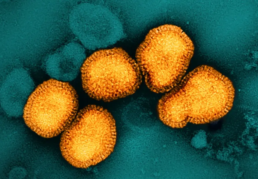 A colorized microscopy image showing influenza virus in orange, with a teal background. The virus looks like roundish blobs.