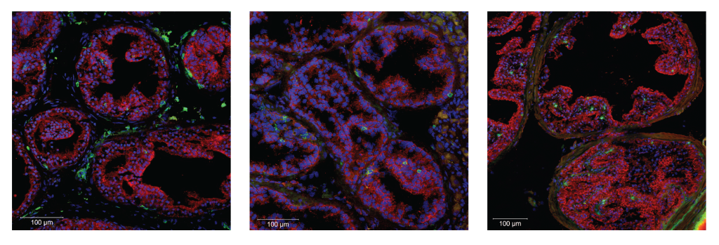 Image with different cell types and structures marked with florescent tags.